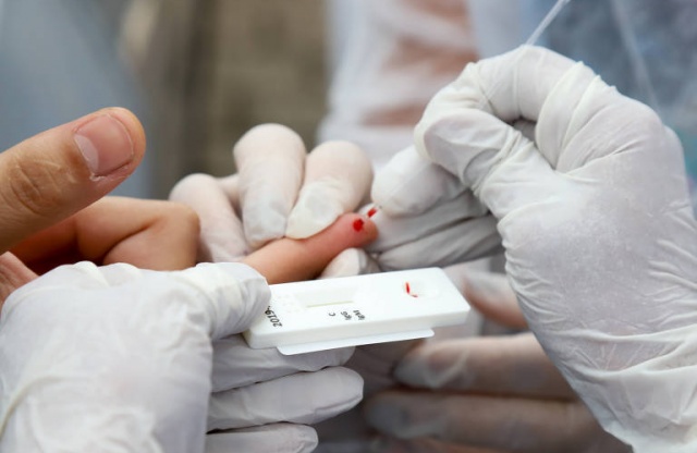 Testes rpidos para Covid-19 s devem ser realizados por profissionais capacitados